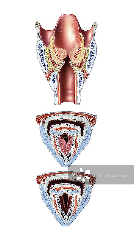 喉头水肿，艺术作品图片素材