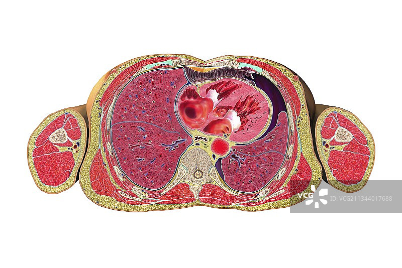 气胸横截面艺术图图片素材