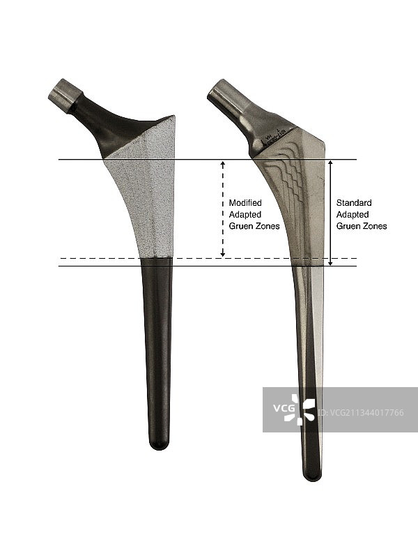 假肢髋关节与格伦区图片素材
