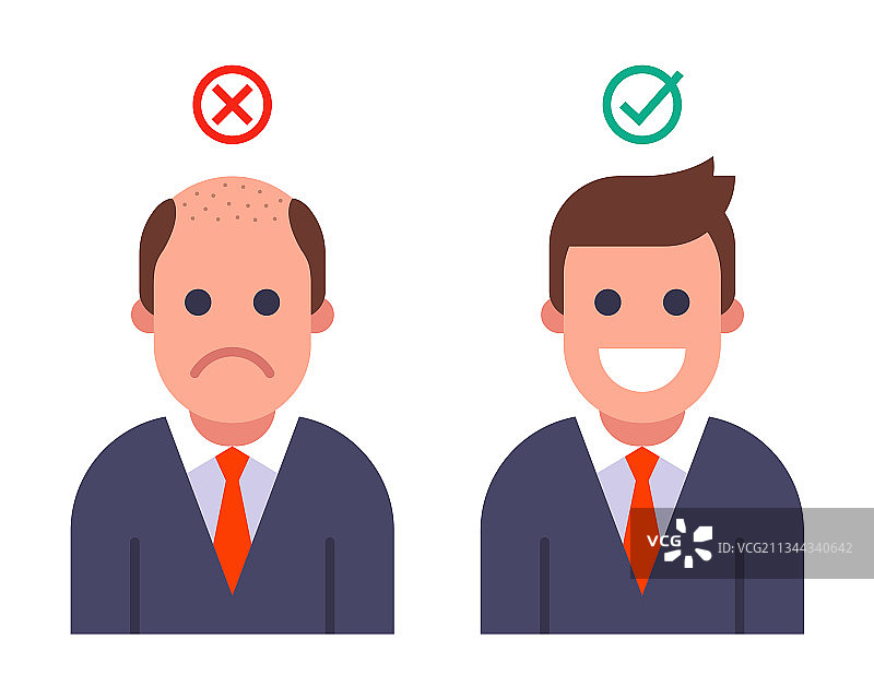 光头男人植发前后的效果图片素材