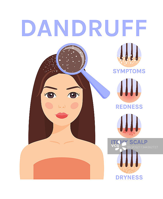 头皮屑特写和可爱的女人图片素材