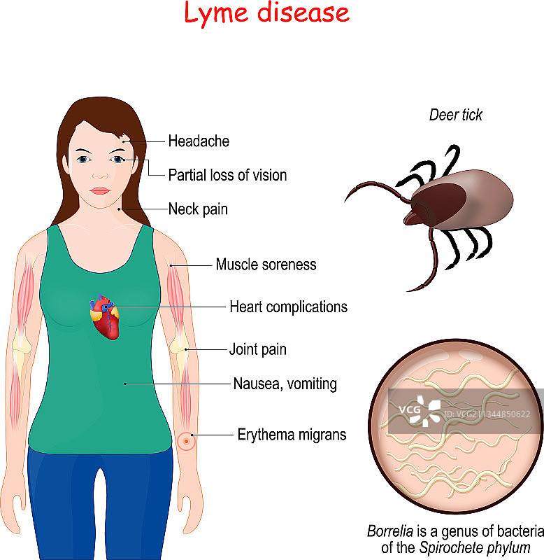 莱姆病图片素材