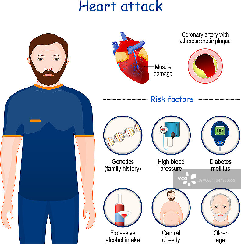 心脏病发作的迹象、症状和风险因素图片素材