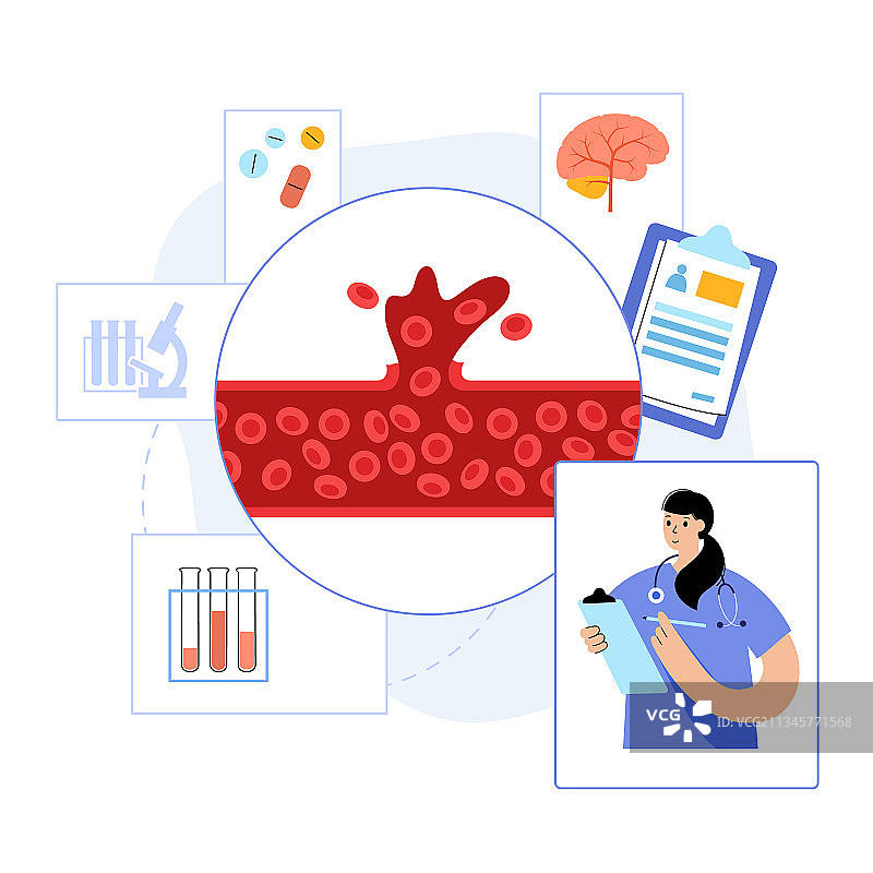 出血性脑卒中图片素材