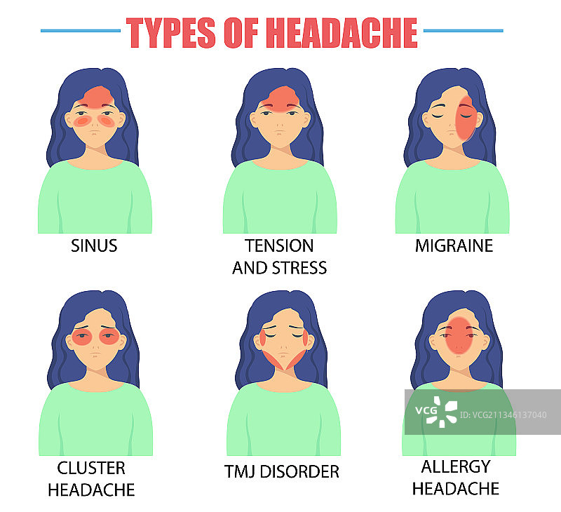 不同类型的头痛图片素材