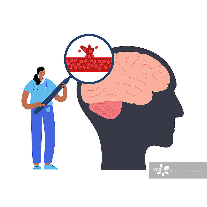 出血性脑卒中图片素材