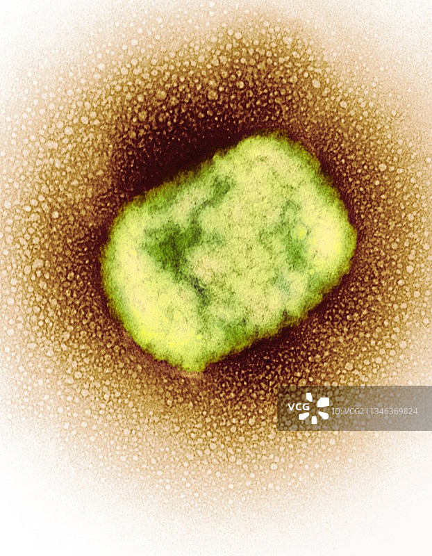 猴痘病毒颗粒（透射电子显微镜）图片素材