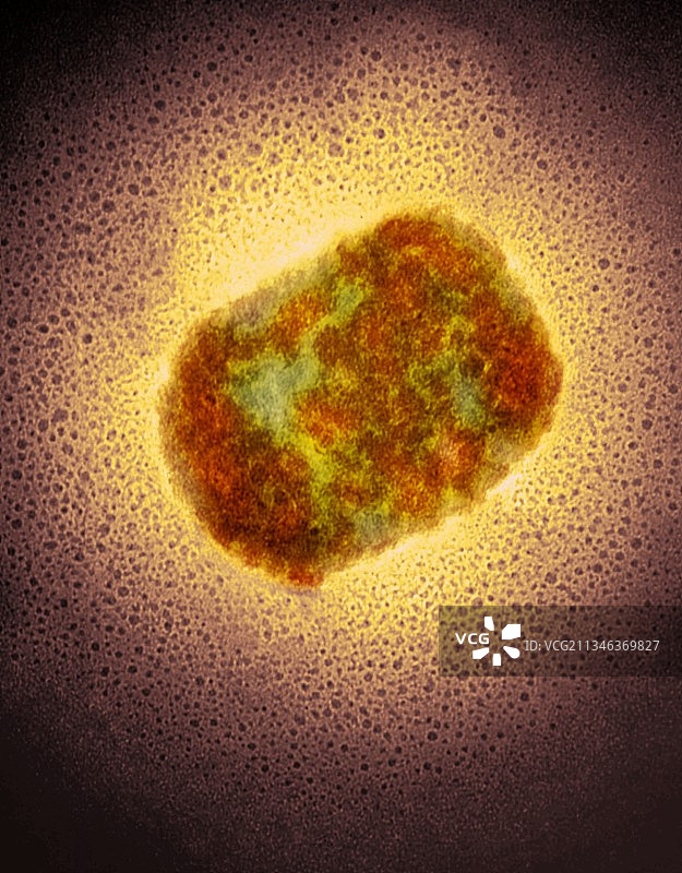 猴痘病毒颗粒（透射电子显微镜）图片素材