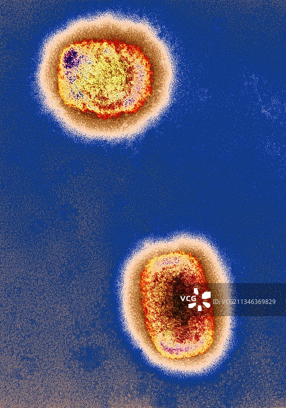 猴痘病毒颗粒，TEM图片素材