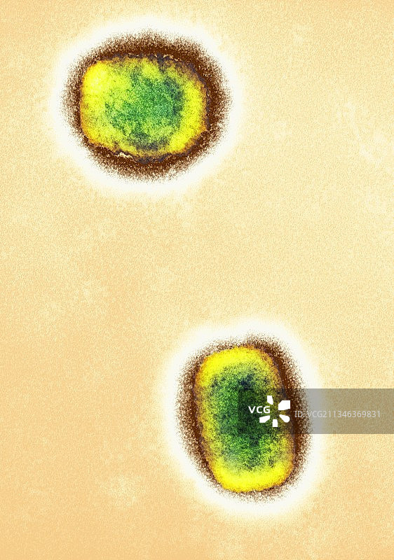 猴痘病毒颗粒，TEM图片素材