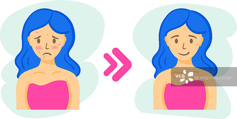 女性面部皮肤痤疮治疗前后对比图片素材