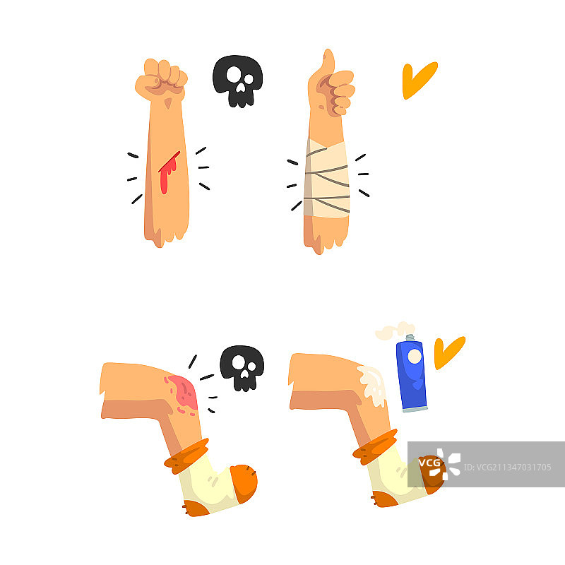 腿部和手臂受伤的急救图片素材