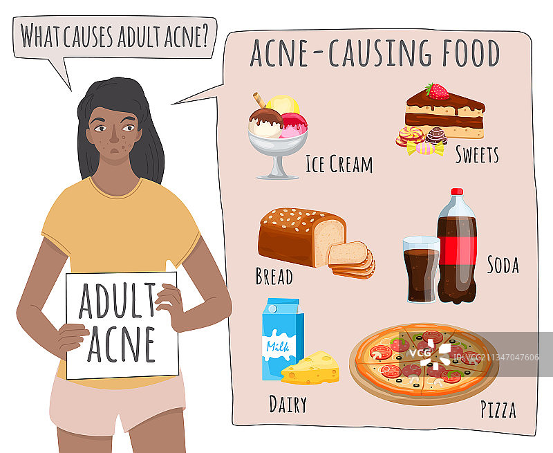 什么导致痤疮？引起痤疮的食物图片素材