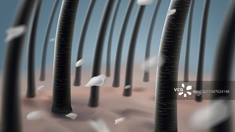 头发出现头皮屑图片素材