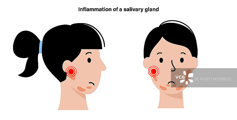 唾液腺概念图片素材