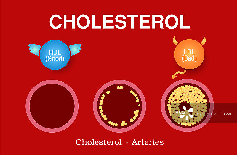 动脉健康风险中的胆固醇图片素材