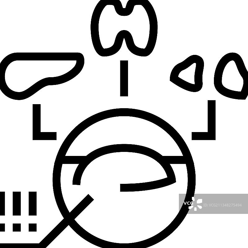 多发性内分泌肿瘤内分泌学线图片素材