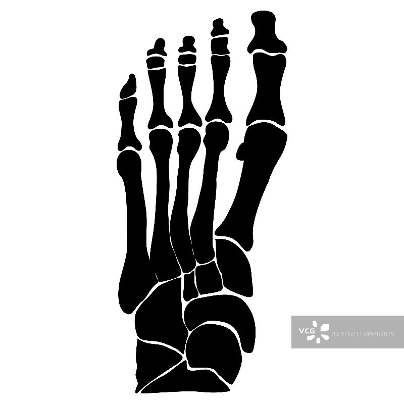 足部骨骼的解剖结构图片素材