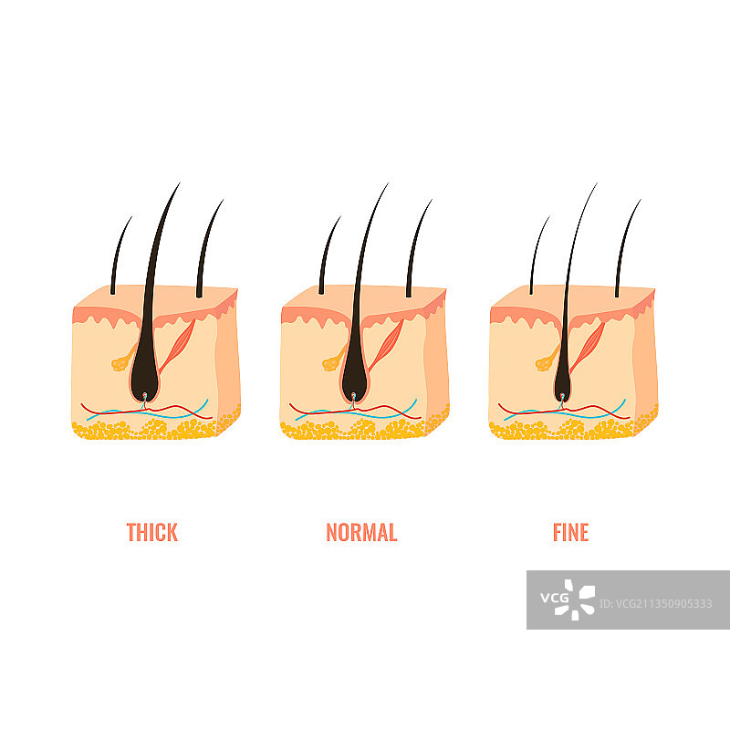 皮肤横截面图中头发宽度结构图片素材