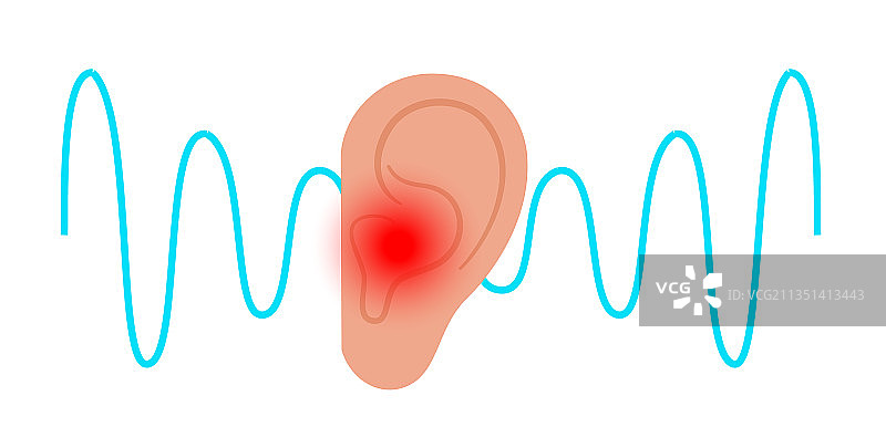 耳鸣疾病概念图片素材