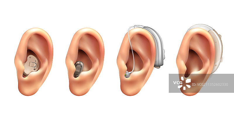 逼真的助听器套装图片素材