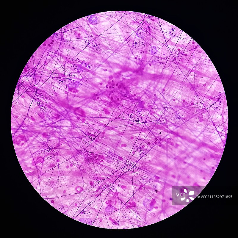 显微镜下交织的结缔组织切片图片素材