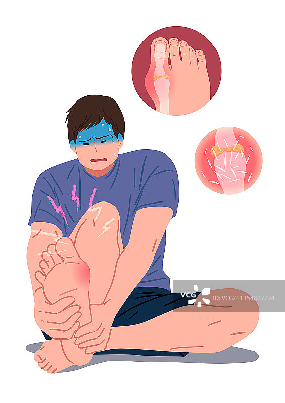 疼痛疾病男性拇外翻骨骼图片素材