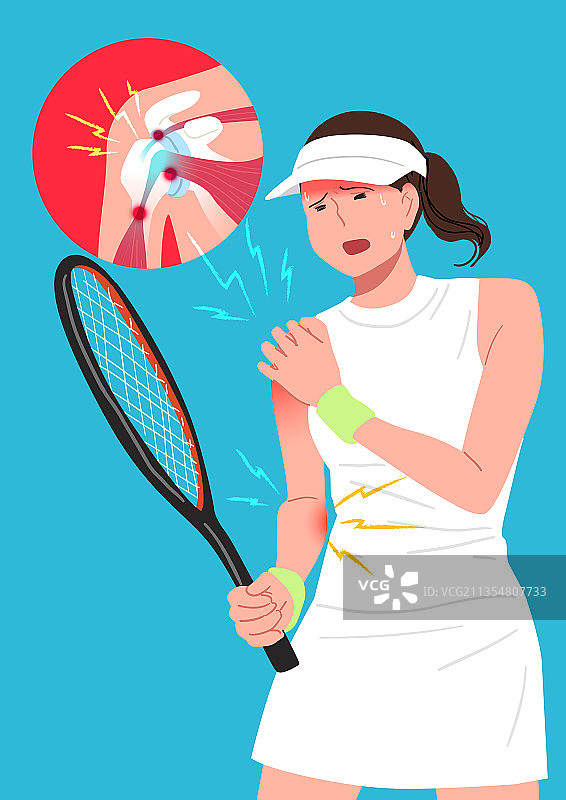 疼痛、疾病、女人、网球、肩痛、肩袖图片素材