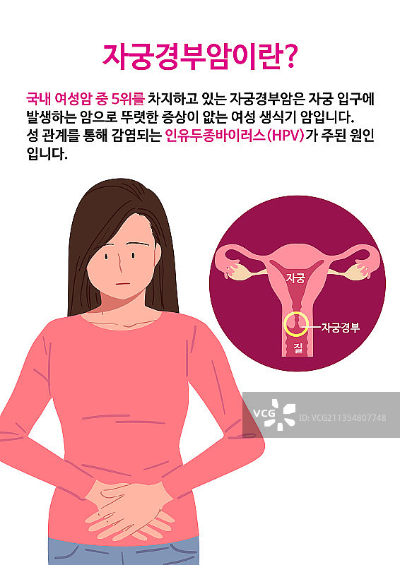 宫颈癌、人乳头瘤病毒、子宫、女性、运动图片素材