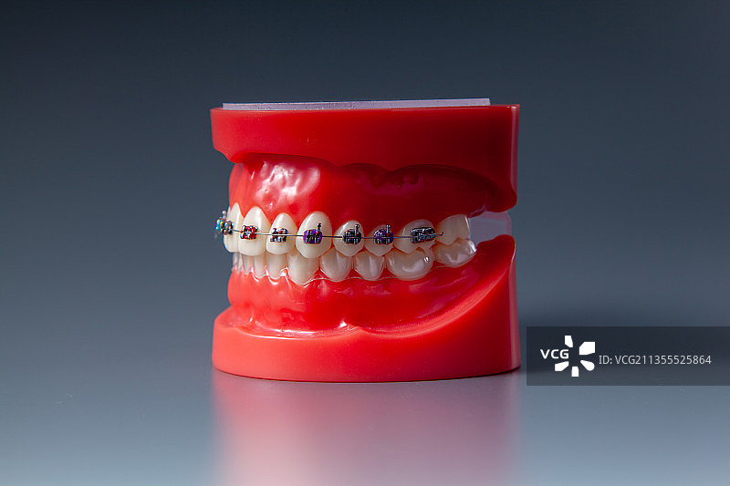 正畸牙齿模型图片素材