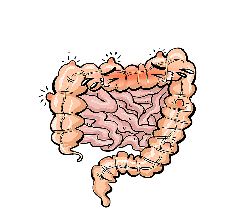 拟人化溃疡性大肠炎图片素材