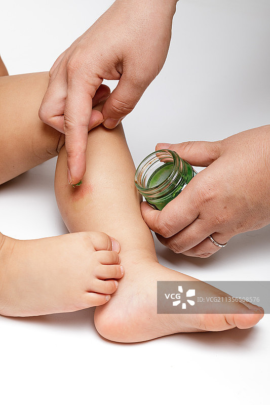 给蚊虫叮咬处涂抹药膏图片素材