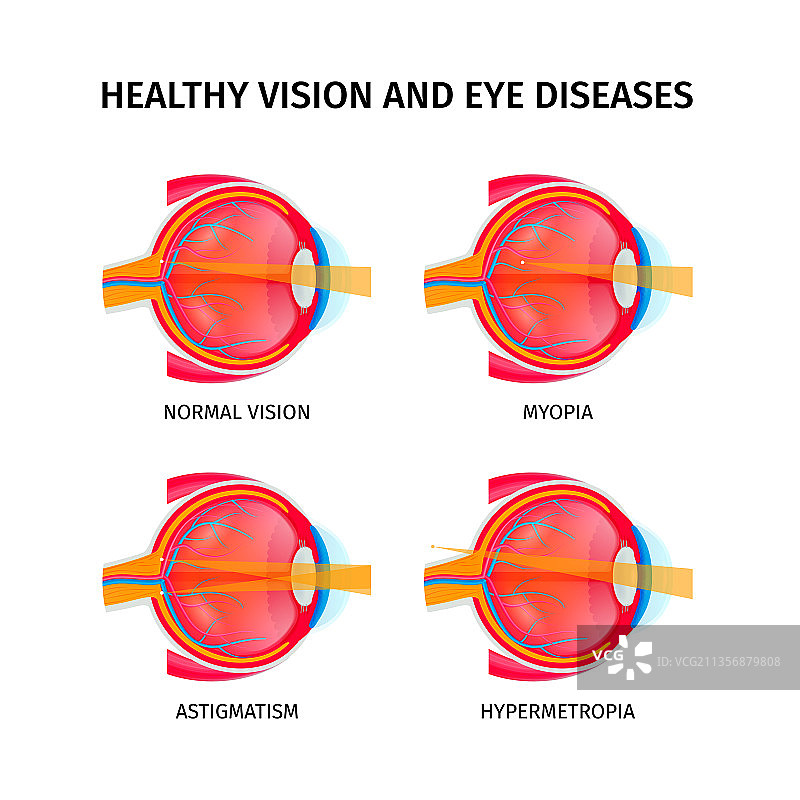 人眼解剖结构图图片素材