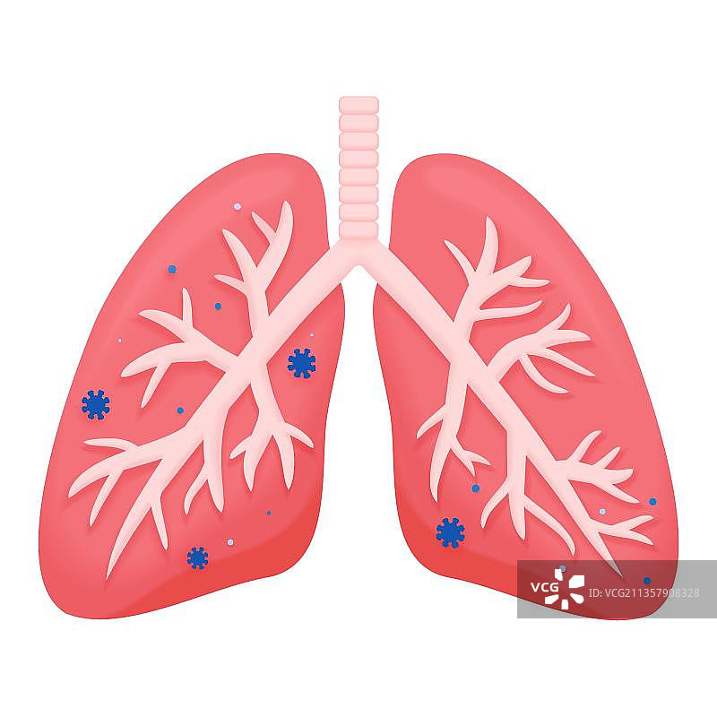 肺部感染图片素材
