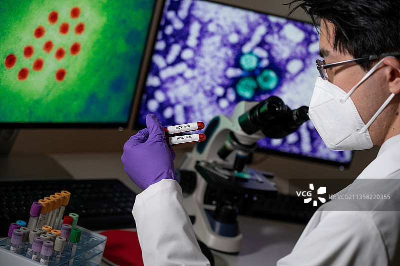 乙型肝炎（HBC）和丙型肝炎（HCV）的血液检查图片素材