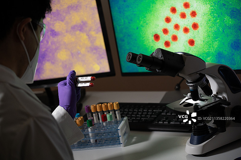 检测乙型肝炎 (HBC) 和丙型肝炎 (HCV) 的血液检测，屏幕上可见病毒图片素材