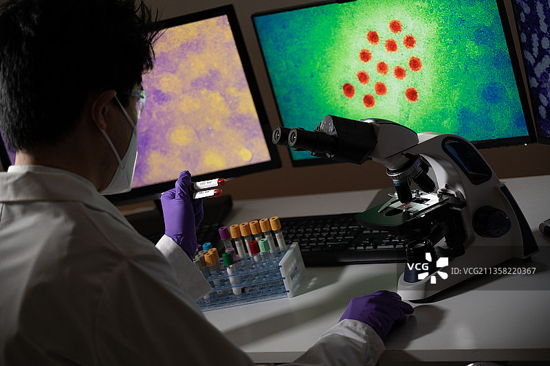 检测乙型肝炎 (HBC) 和丙型肝炎 (HCV) 的血液检测，屏幕上可见病毒图片素材