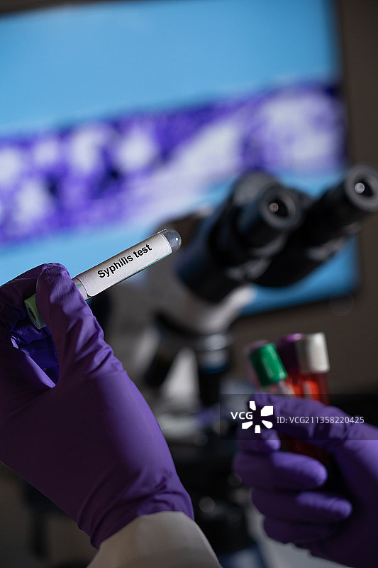 梅毒血液检测：由苍白密螺旋体引起的性传播感染图片素材