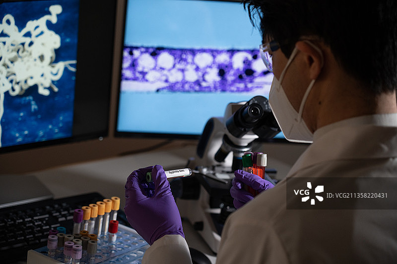 梅毒血液检测：由苍白密螺旋体引起的性传播感染图片素材