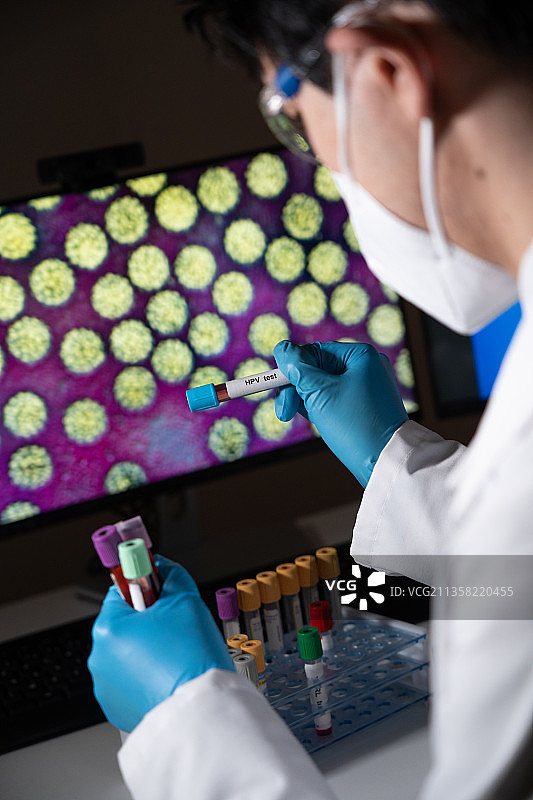乳头瘤病毒检测。病理学癌症健康图片素材