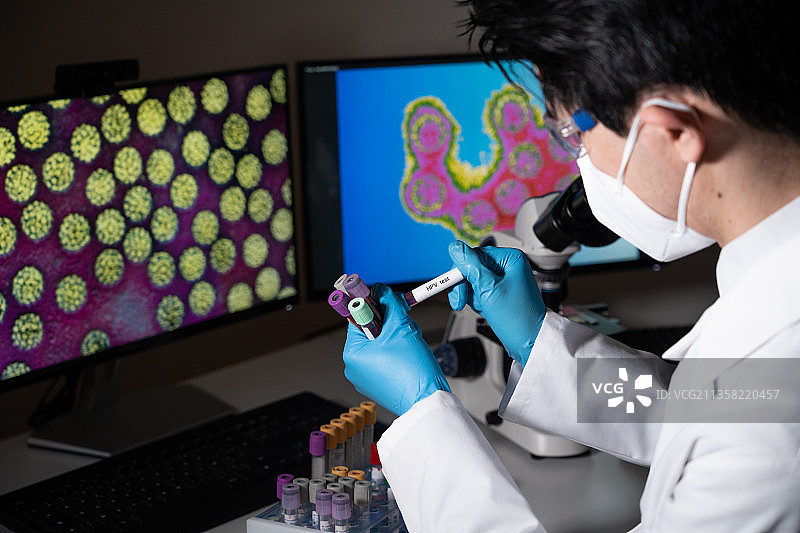乳头瘤病毒检测。病理学癌症健康图片素材