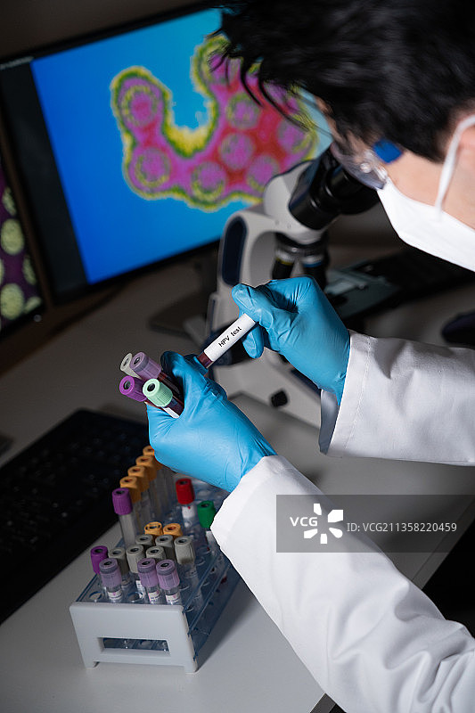 乳头瘤病毒检测。病理学癌症健康图片素材