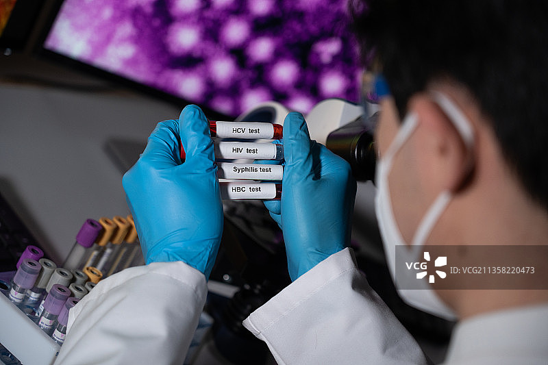 用于检测性传播疾病的血液检测：乙型和丙型肝炎、梅毒、艾滋病毒图片素材