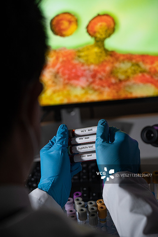 用于检测性传播疾病的血液检测：乙型和丙型肝炎、梅毒、艾滋病毒图片素材