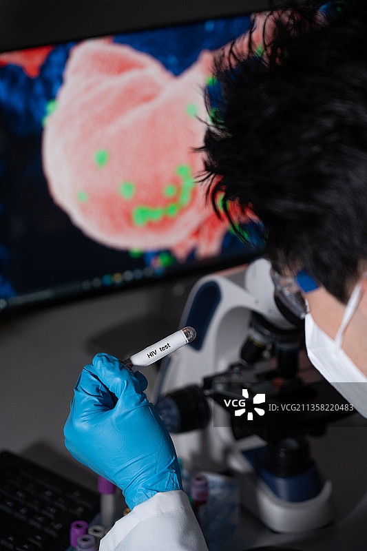 用于检测性传播疾病的血液检测：乙型和丙型肝炎、梅毒、艾滋病毒图片素材