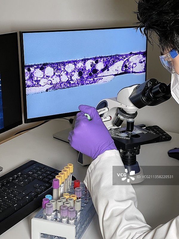 实验室助理使用计算机研究苍白密螺旋体图像图片素材