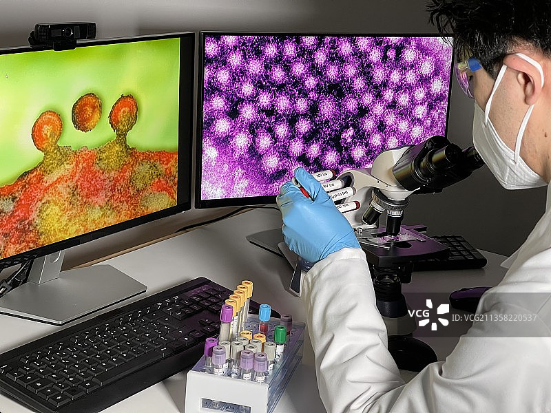 实验室技术员在电脑上研究艾滋病毒图像图片素材