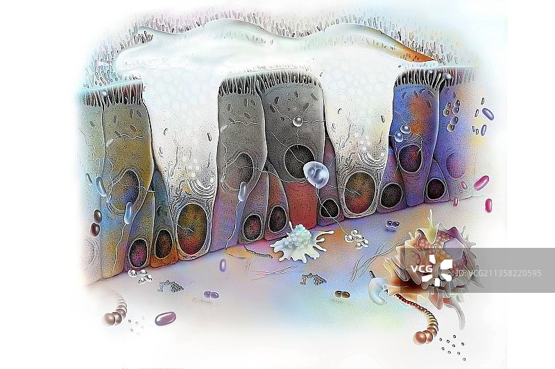 鼻黏膜炎症：黏液过多和巨噬细胞的存在图片素材