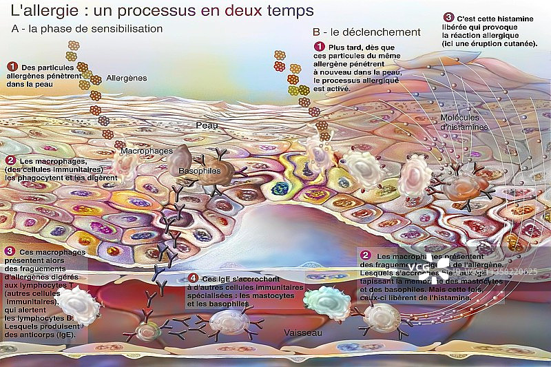 过敏反应分两个阶段：致敏和反应图片素材