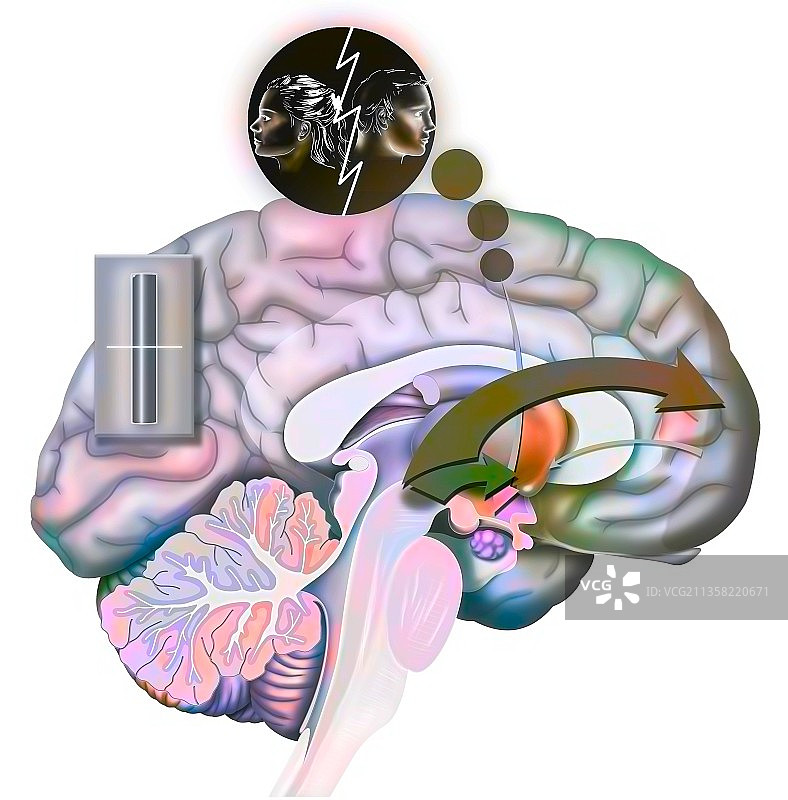 渴望与破裂（状态3）：浪漫分离后大脑的反应图片素材